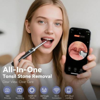 Tonsil Stone Remover Kit